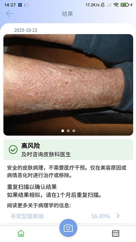 医用皮肤镜影像处理软件