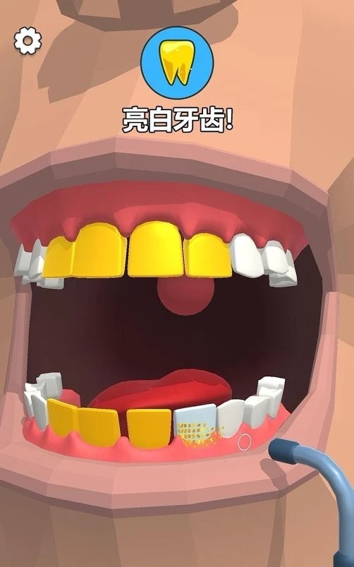 拔牙吗我贼6(Dentist Bling)