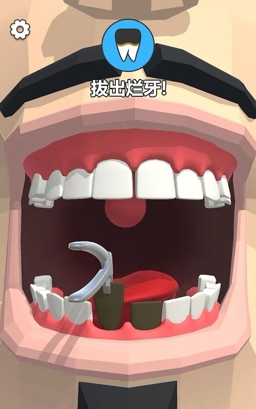 拔牙吗我贼6(Dentist Bling)