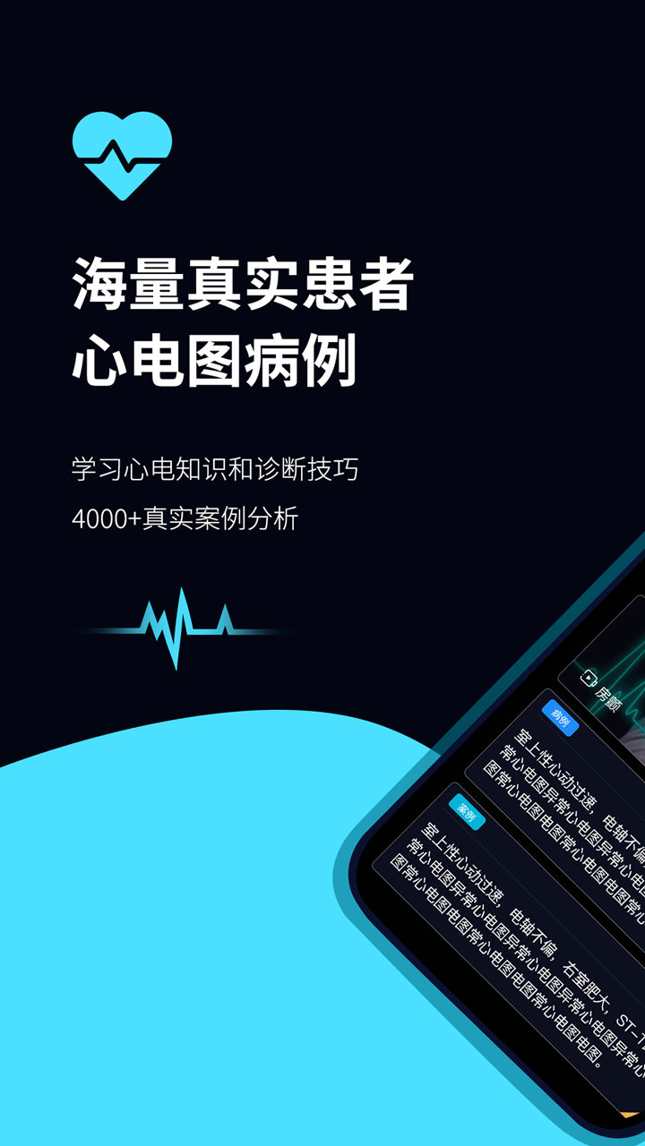 心电图ECG 心电图ECG