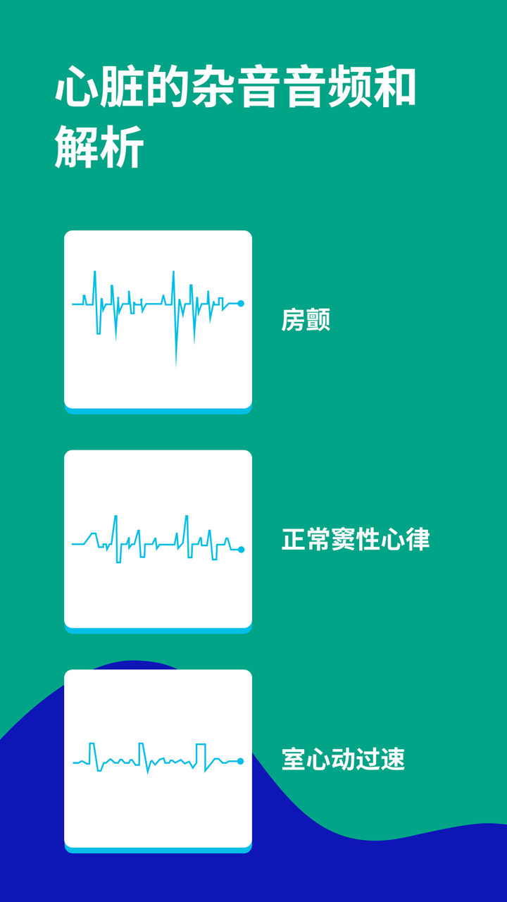 心电图ECG 心电图ECG