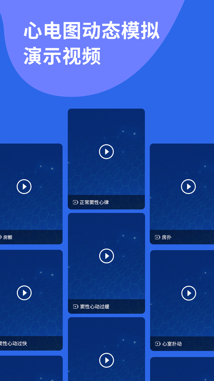 心电图ECG 心电图ECG