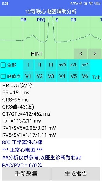 健康2030智能读图心电图系统V1.0 健康2030智能读图心电图系统V1.0