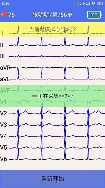 健康2030智能读图心电图系统V1.0 健康2030智能读图心电图系统V1.0