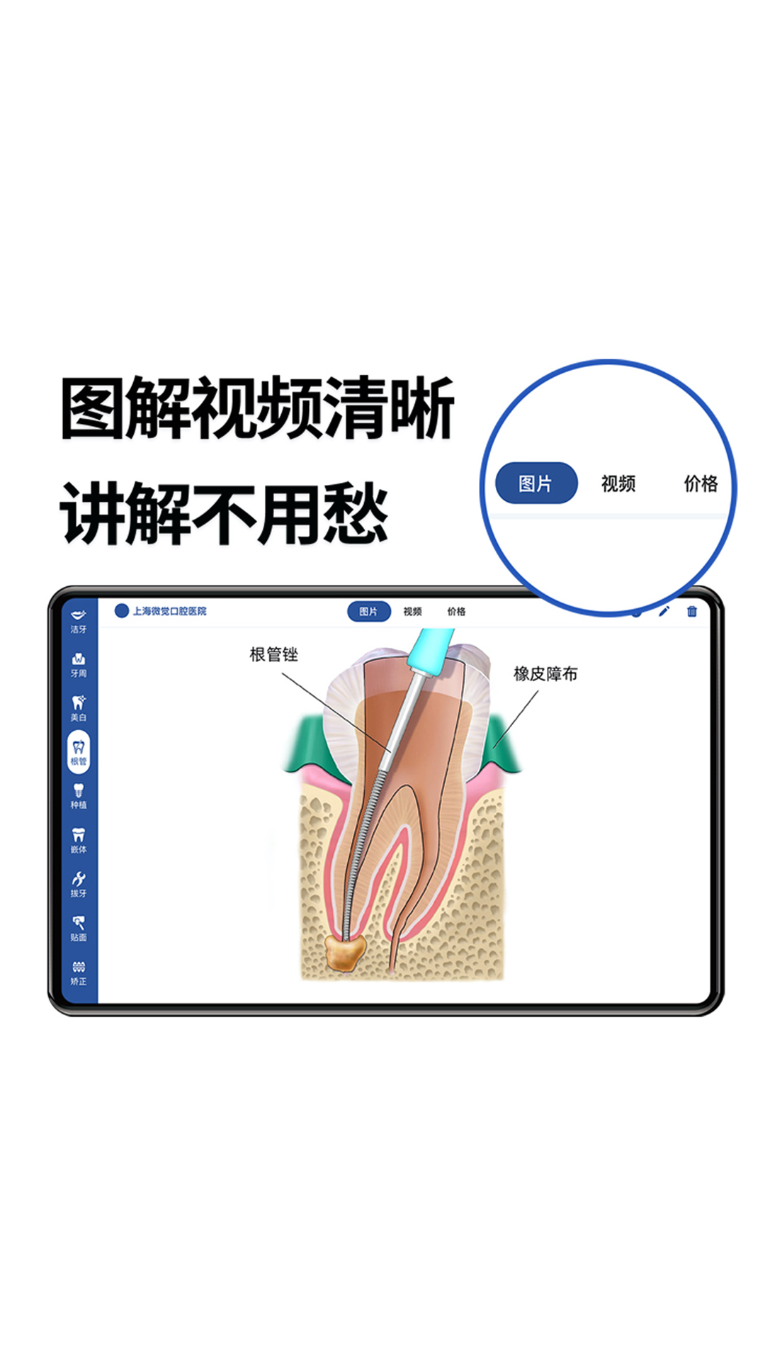 一分钟报价