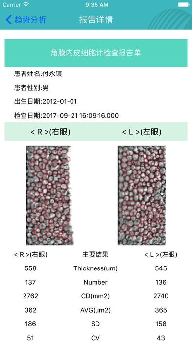 视觉健康