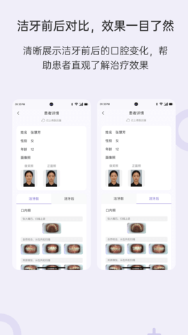 乐齿拍