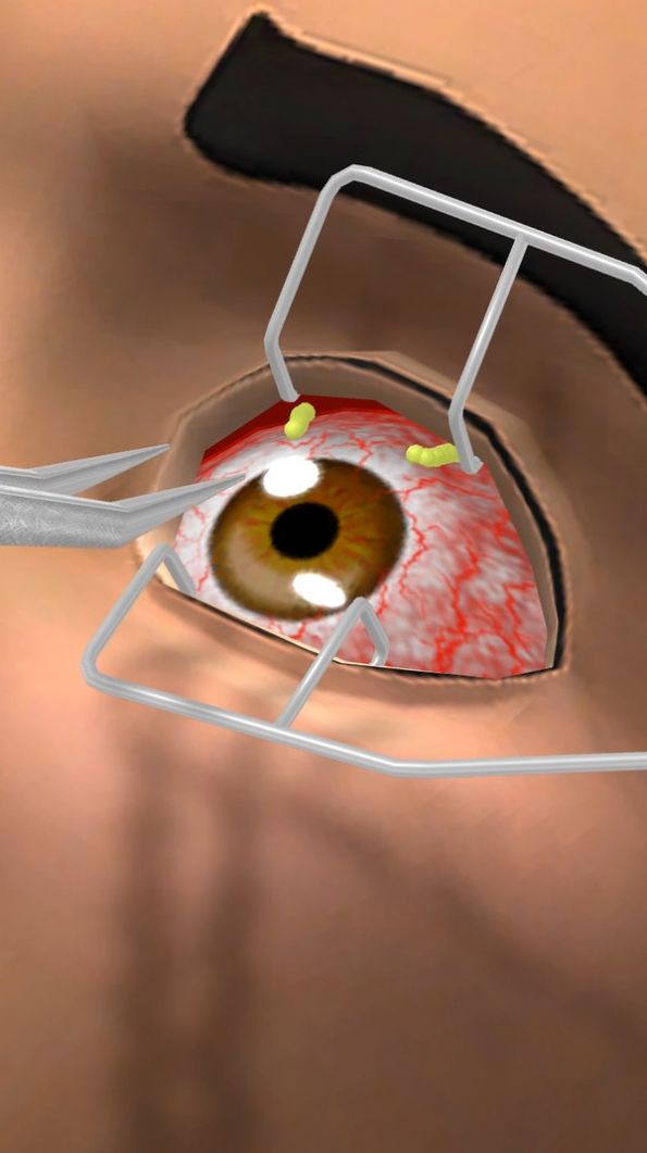 小视眼科医生端