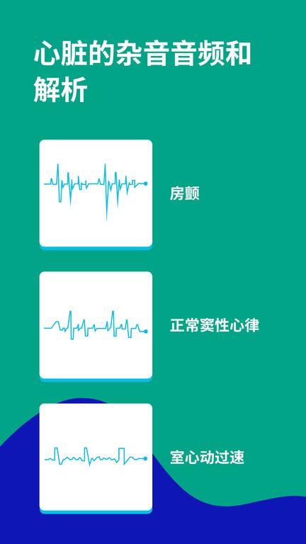心电图ECG 心电图ECG