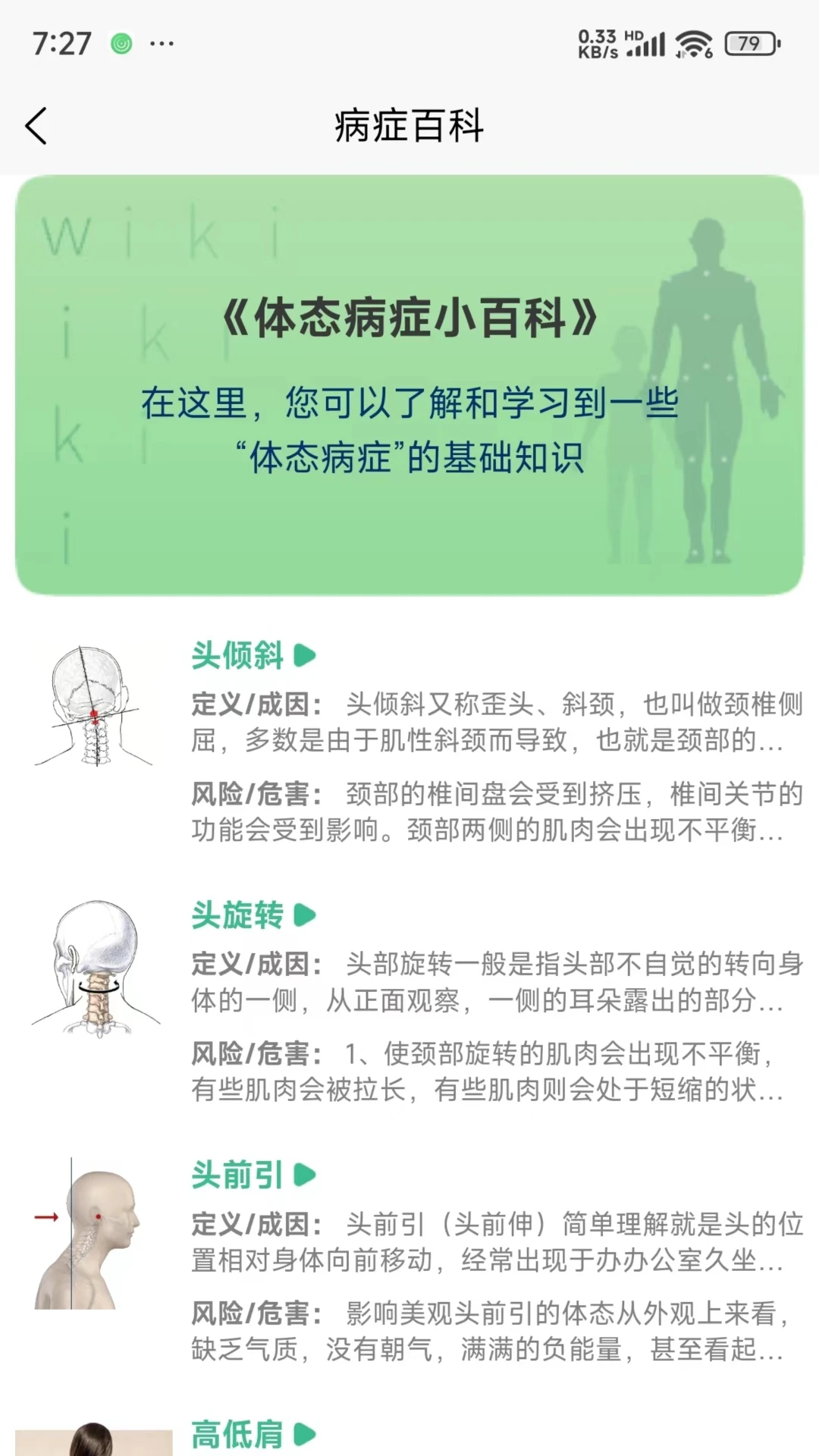 BodyLang体态评估