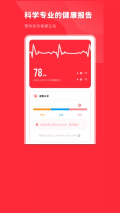 口袋心电图 口袋心电图