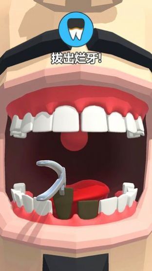 拔牙大师dentist bing