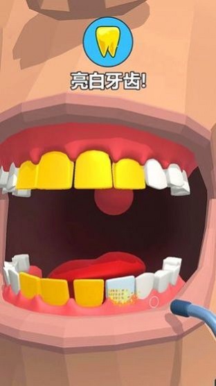 拔牙大师dentist bing
