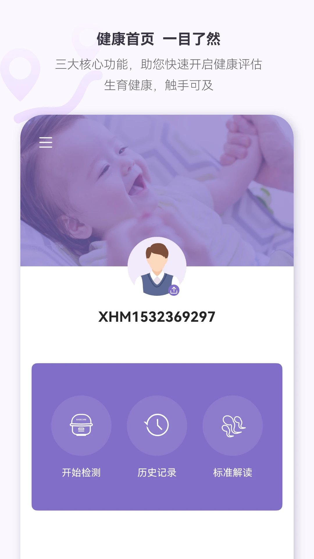 便携式精子质量分析仪